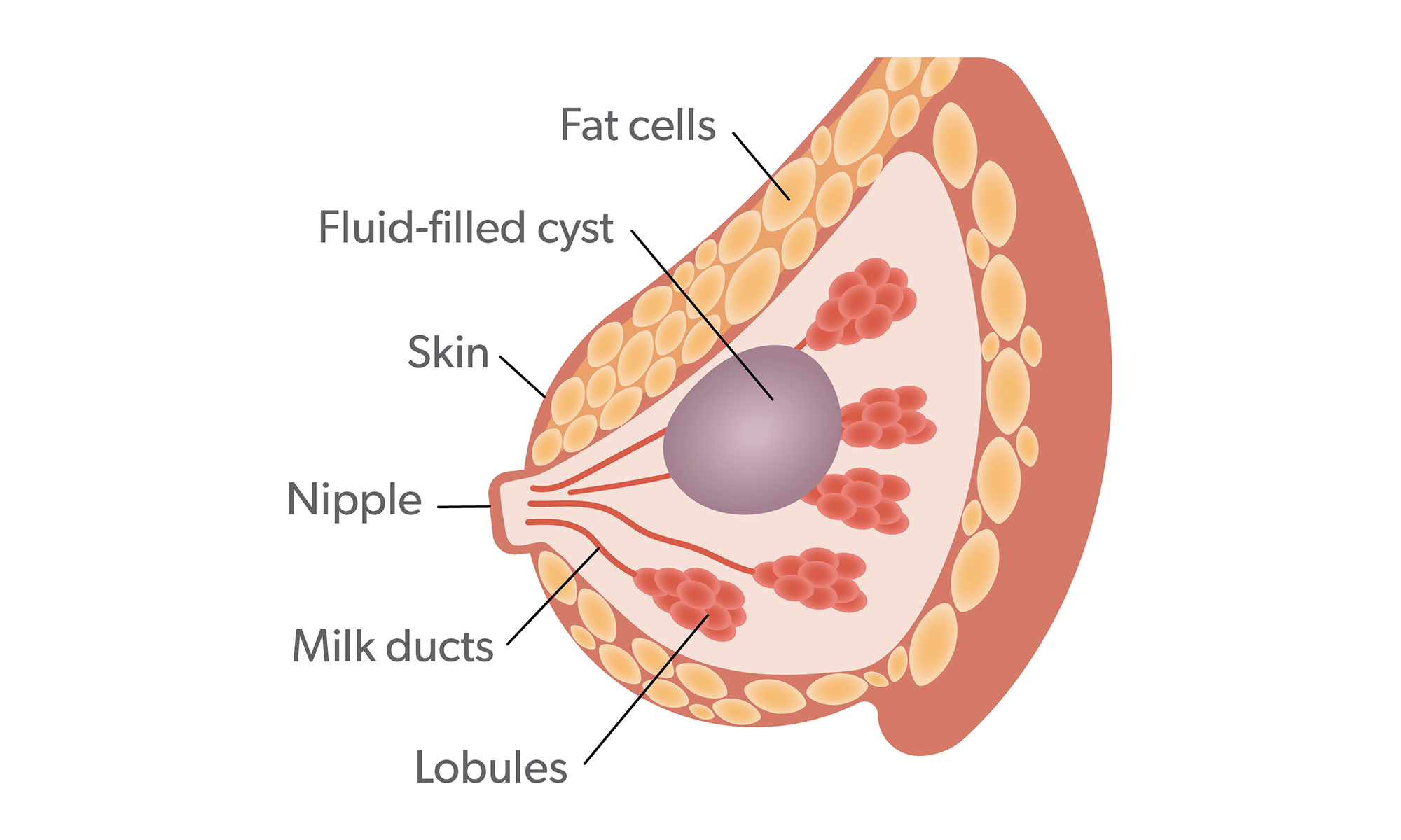 Cyst in breast pain relief - How to Heal Dense, Fibrotic & Tissue