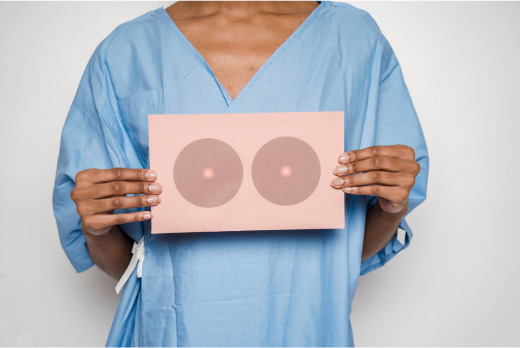 Breast Cancer Surgery: What you need to know