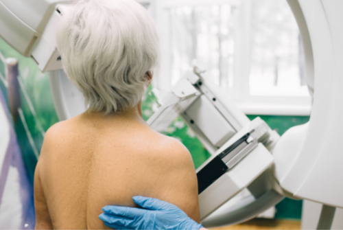 Amazing news, free mammogram age extension begins